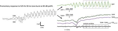 Putative Auditory-Evoked Neurophonic Measurements Using a Novel Signal Processing Technique: A Pilot Case Study